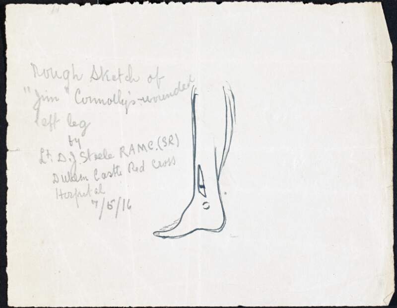 Rough sketch of "Jim" Connolly's wounded left leg by Lt. D.J. Steele RAMC (SR) Dublin Castle Red Cross Hospital,