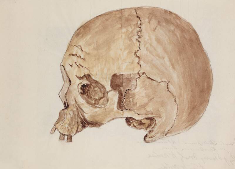 Female skull preserved - RI Academy Museum, from Knockmaroon Cairn